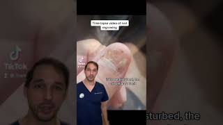 Hand surgeon Nick Pappas MD discusses nail growth #acrylicnails #Nail #Regrow #Medical #Hand #Finger