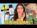 Don’t Waste Your Money On Acne Products — Skincare Scams To Watch For & What To Know!