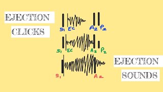 Ejection sounds/ ejection clicks