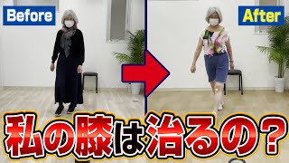 【膝の再生医療体験談】PRP-FD治療後のひざ痛が改善した症例