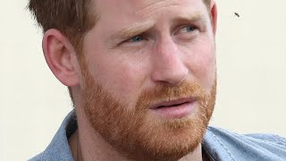Expert Reveals The Truth About Prince Harry's Hair