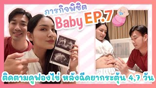 👧🏻ภารกิจพิชิตBaby (Ep.7) คลิปนี้มาติดตามฟองไข่หลังฉีดกระตุ้นไข่ไปแล้ว 4 วันและ 7 วัน