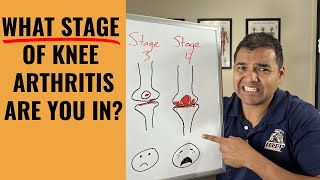How To Clearly Tell Where You Are In The 4 Stages Of Knee Arthritis