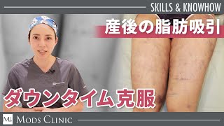 【出産後によくあるお悩み】脂肪吸引後のダウンタイム／ボァイエ真希子 医師｜Mods Clinic（モッズクリニック）