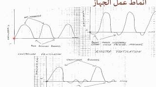 كيف يعمل جهاز التنفس الصناعي