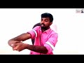 de quervain s tenosynovitis treatment exercises explaination in tamil finkenlstein test dr.sasidurai