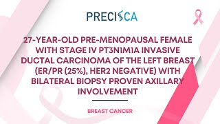 Expert Cancer Panel: Stage IV IDC (ER/PR+, HER2-) w/ bilateral biopsy-proven axillary involvement