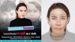 ศัลยกรรมปรับโครงหน้าและใบหน้า ตามไอดอลสาว ชาวเกาหลี ในคลิปนี้ทำศัลยกรรมอะไรบ้าง ? ไปดูกัน !! SLC