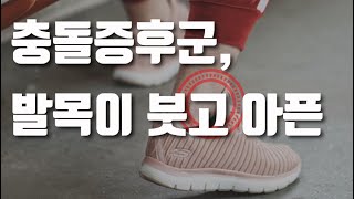 발목충돌증후군, 자꾸 붓고 아프다면