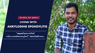 Living with Ankylosing Spondylitis | Akhil's story | Dr Padmanabha Shenoy - Episode 2