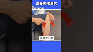 【膽囊炎、膽結石特效穴】30秒超有效解痛，膽囊發炎結石者必看！！ #shorts #高醫師說 #中醫 #高晧宇中醫師 #痠痛