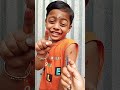 injection video 😍 baby crying😭 shorts funny cute baby crying funny youtubeshorts viral