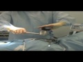 Solo Laparoscopic Supracervical Hysterectomy (LSH) with the VIKY® Robot by Richard Rosenfield MD