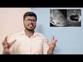 நிலவில் குகை மனிதர்கள் இருக்கலாமா moon facts in tamil vintage tamilan