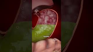 What S Really Causing Your Bloating