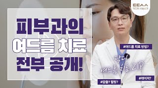 피부과에서 하는 여드름 치료, 싹 다 알려드림 | 닥디의 시술소개📡