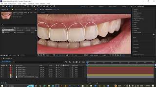 Smile lines Tutorial | Dental Motion Graphics