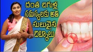 Bleeding Gums | Dental Problem | దంత సమస్యలు | Telugu Health Tips