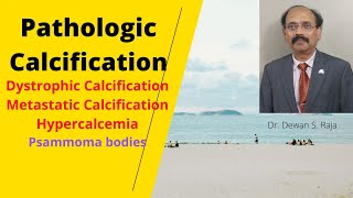 Pathologic Calcification