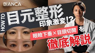 【眼瞼下垂×目頭切開】目元カスタムで印象激変！？人の第一印象は目だ！BIANCA CLINIC