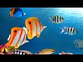 Relaxing Guitar Music, Calming Music, Relaxation Music, Guitar Music, Sleep Music, Study Music ☯3562