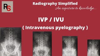 IVP ll Intravenous pyelography ll Intravenous urography ll Radiography simplified ll