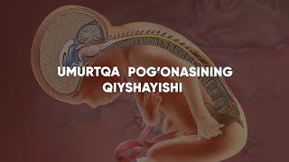 Umurtqa pogʼonasining qiyshayishi - MEDO