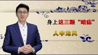 身上这三颗“暗痣”，人中龙凤，衣食无忧，别轻易点掉