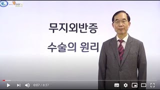 [발질환, 무엇이든 물어보세요] 무지외반증 수술 원리