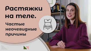 ГОВОРИМ ПРО РАСТЯЖКИ | Стрии и Их Неочевидные Причины | 18+