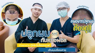 ปลูกผม ทั้งทีต้องมา All About Clinic จบทุกปัญหา