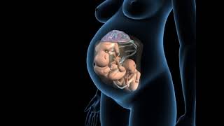 Types of triplets pregnancy - Monochorionic triamniotic triplets - 3D Anatomical Visualization