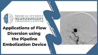 Applications of Flow Diversion using the Pipeline Embolization Device