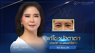 คุณต๊ะ นารากร‼ แก้ไขปัญหาหนังตาตก ด้วยเทคนิคซ่อนแผลไว้ใต้คิ้ว Sub Brow Lift