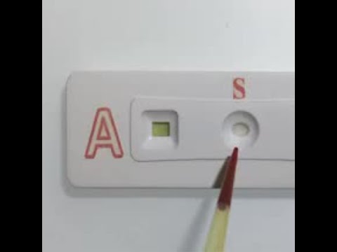 Paper strip test determines blood type Paper strip test determines blood type