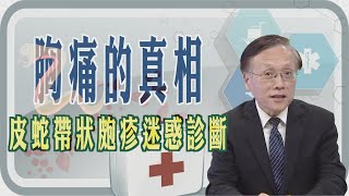 【胸痛的真相😖皮蛇帶狀皰疹迷惑診斷🐍🩺】【大愛醫生館精選】