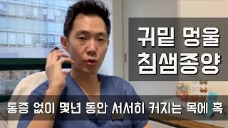 [목멍울#05] 귀밑 멍울, 침샘종양 - 통증 없이 몇년 동안 서서히 커지는 목에 혹 - 위드심의원 목에혹 클리닉