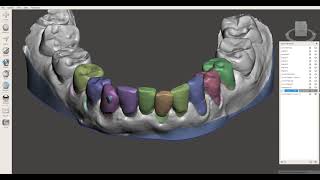 Meshmixer - Aligner Project