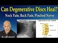 Can Degenerative Discs Heal Normal Again?  (Neck Pain, Back Pain, Pinched Nerve) - Dr Mandell