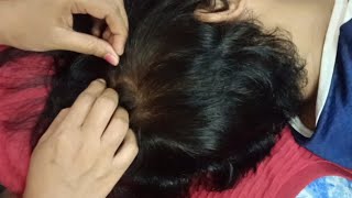 ASMR - Scalp searching sleep and relaxation - no talking -64