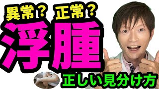 浮腫（むくみ）の正常/異常の見分け方〜原因〜対処法〜注意点について、慢性腎臓病も含めて腎臓内科専門医が解説。