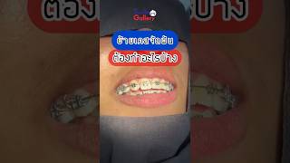 💬คำถามยอดฮิตอยากย้ายเคสต้องทำยังไง? | Smile Gallery Dental Clinic