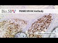 bio sb 2021 prame ihc antibody