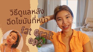 วิธีดูแลตัวเองหลังฉีดไขมันที่หน้า | Fat Graft ep2 #ฉีดไขมัน #ดูดไขมัน