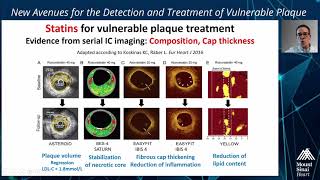 Pharmacologic Treatment of Vulnerable Plaque: Background and the PACMAN-AMI Study - Dr. Lorenz Raber