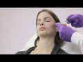 juvederm voluma with liz and dr. harper