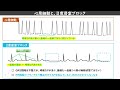 心電図　【心房細動　af】【心房細動と間違いやすい不整脈】ゼロから心電図検定4級3級