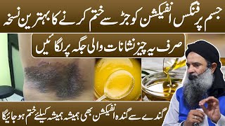 Fungal Infection Treatment | Fungal Infection Ka ilaj | Fungus Ka ilaj in Urdu Dr Sharafat Ali New