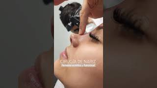 RINOPLASTIA FEMENINA #cirugiadenariz #beauty #rhino #nosejob #beautymakeup