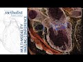 Cardiac CT: Current Technology & Basic Principles (Su Min Chang, MD) September 21, 2021